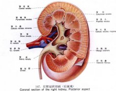 合理的饮食能将肾结石